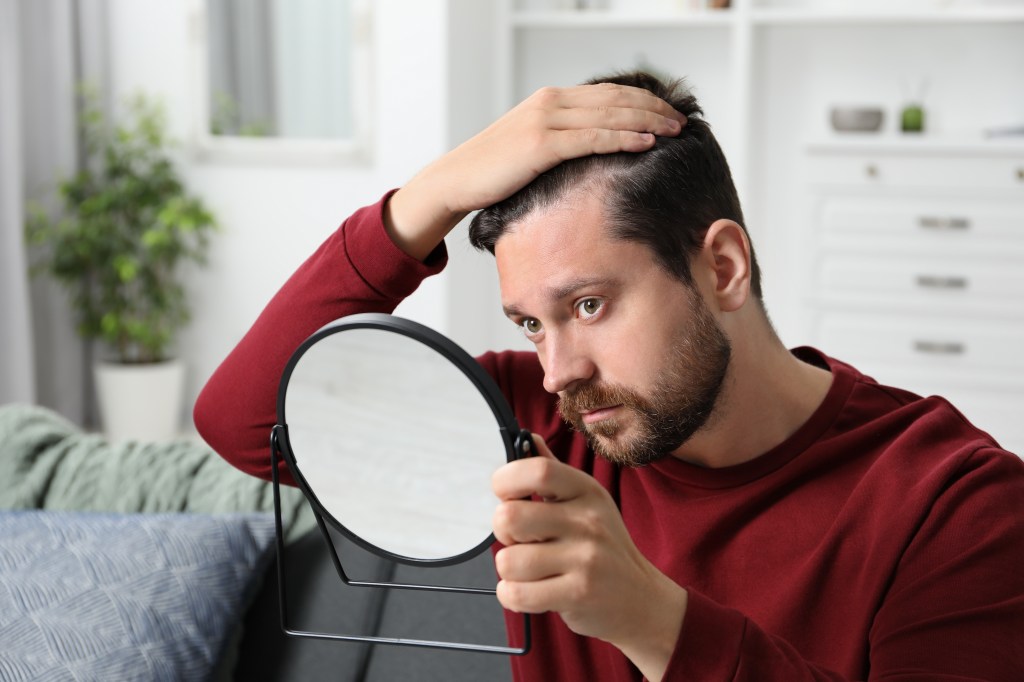 Man checking his hairline, looking for anxious