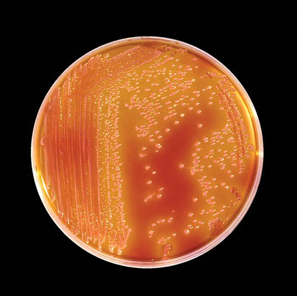 Serratia marcescens bacteria on a petri plate with orange juice.