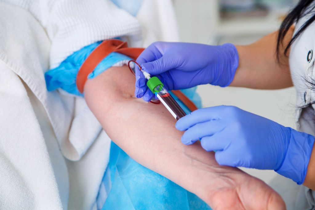 The doctor attracts a patient's blood.