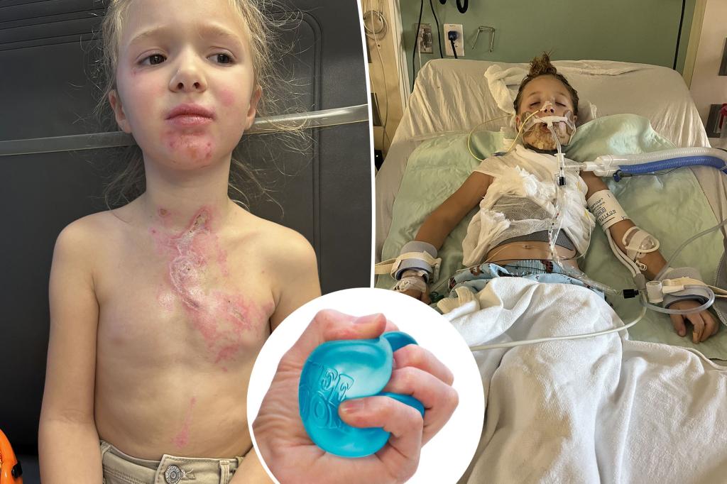Girl, 7 years old, in coma with terrible burns after Tiktok Challenge