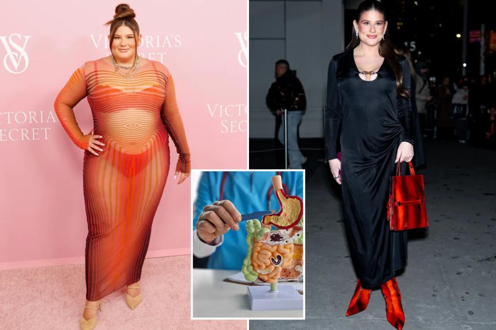 What is Sadi? Surgery for more weight loss than stomach sleeves