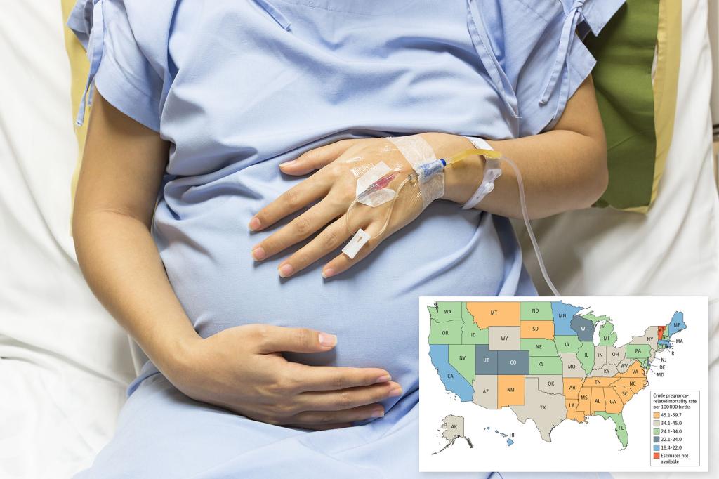 Massive spike in pregnancy -related death in the SH.BA