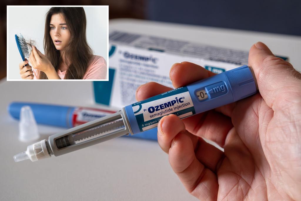 Ozempic, weight loss medication cause hair loss, new study reveals